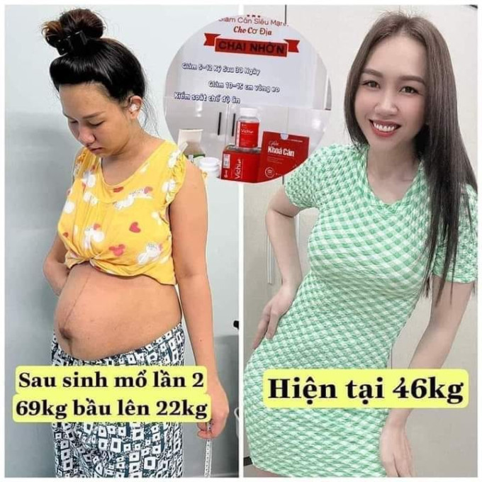 Vichi giảm cân hiệu quả được nhiều khách hàng tin dùng