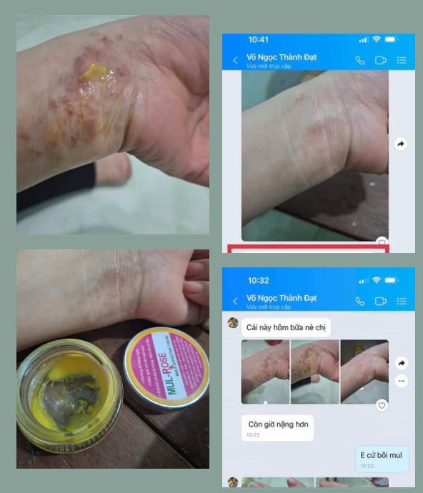 Khách hàng sử dụng mulrose sau 1 thời gian có hiệu quả