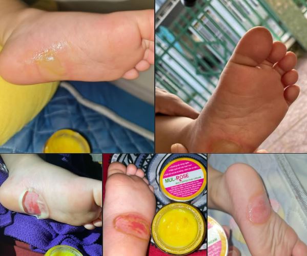 Review đánh giá kem nghệ mul rose từ khách hàng