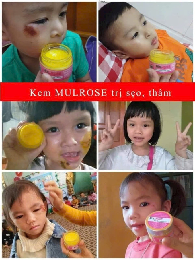 Kem mul rose chính hãng an toàn hiệu quả được nhiều khách hàng tin dùng