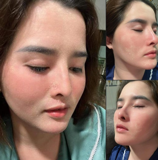 Tái tạo da mới, trắng sáng, đều màu.
