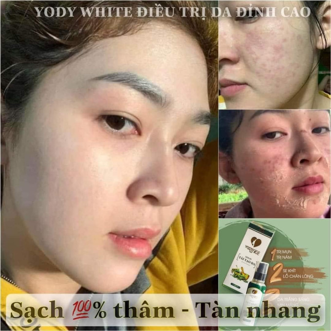 Serum Tái Tạo Da Yody White có tốt không