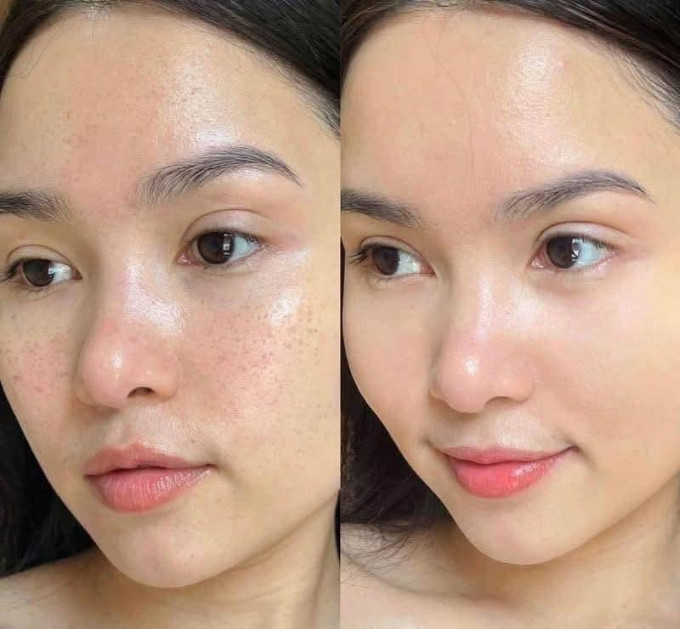 Bộ nám Mommy Care được sản xuất theo công nghệ Hàn Quốc hiện đại