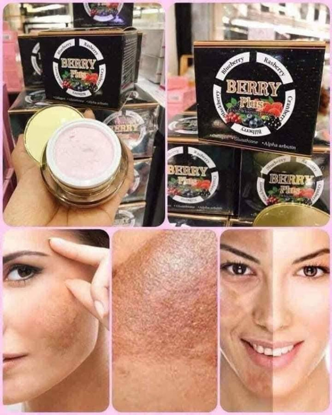 Hỗ trợ giảm nám, tàn nhang và đốm nâu trên da