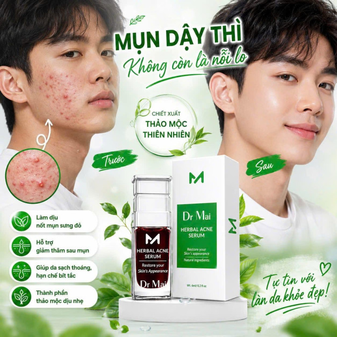 Hỗ trợ giảm mụn đầu đen, mụn cám, mụn ẩn và mụn viêm nhẹ.
