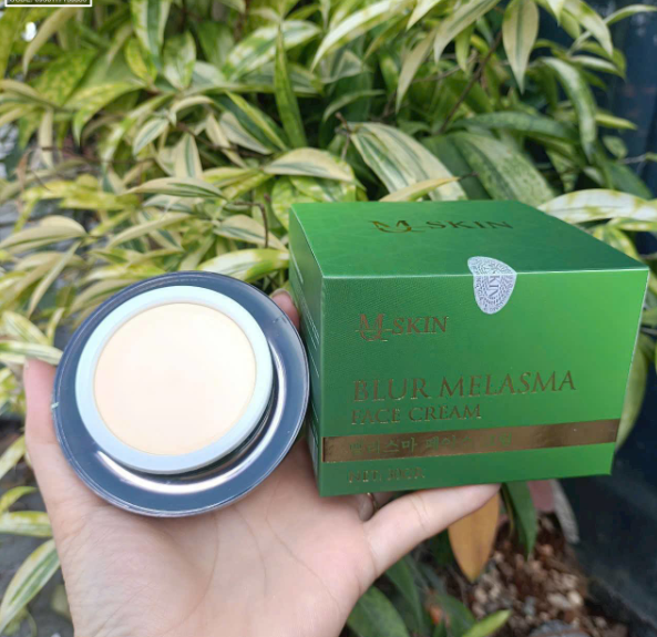 Kem Face Nám MQ Skin Melasma – Kem Dưỡng Hỗ Trợ Chăm Sóc Da Sạm Nám